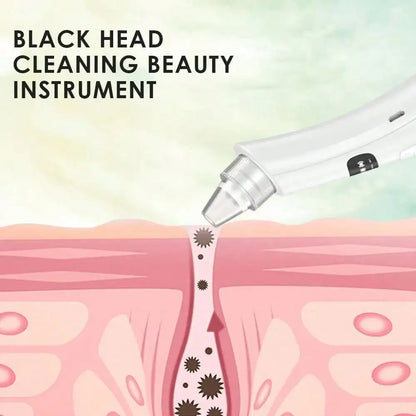 Blackhead Remover Vacuum Pro – Deep Pore Cleansing Device